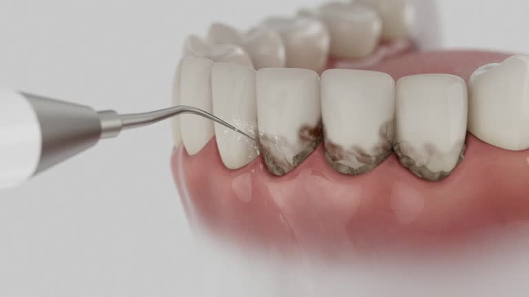 Trusted Emergency Dentist service in Bushnell, IL - Dentist Open Now